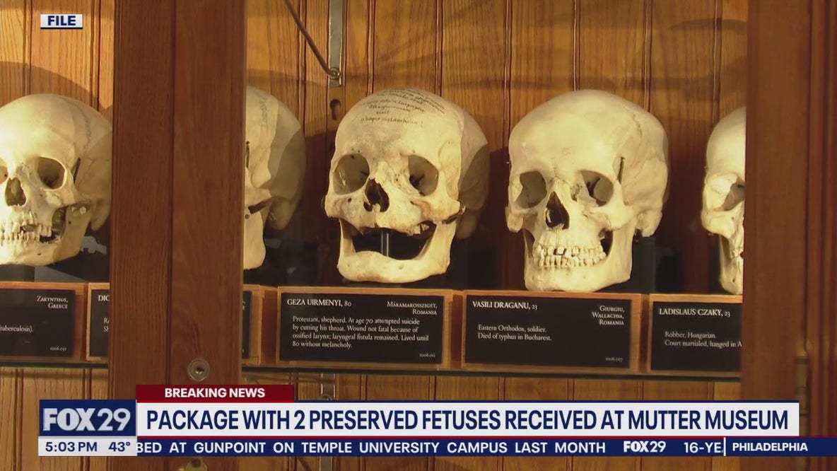 Package with 2 preserved fetuses received at Mutter Museum